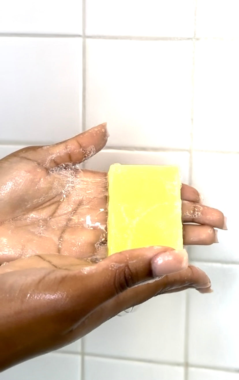 Acne prone skin clarifying soap