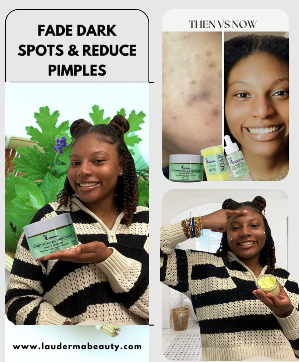 Brown Sugar Scrub Body care Body Scrub Lauderma