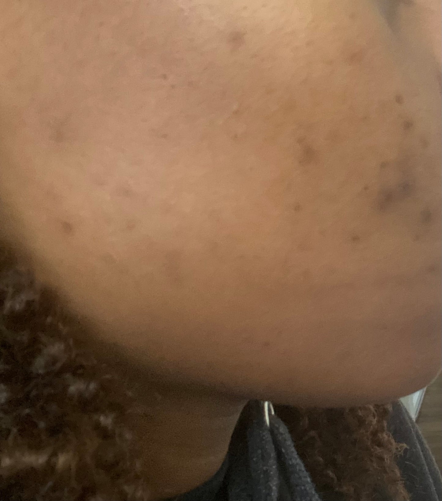 Revitalizing Cleanser: Acne Prone Skin