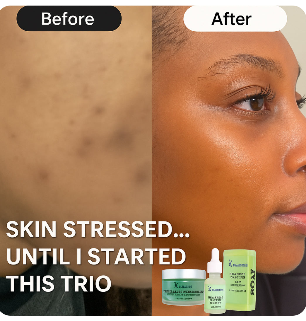 Clarifying Acne-Prone Facial Bundle