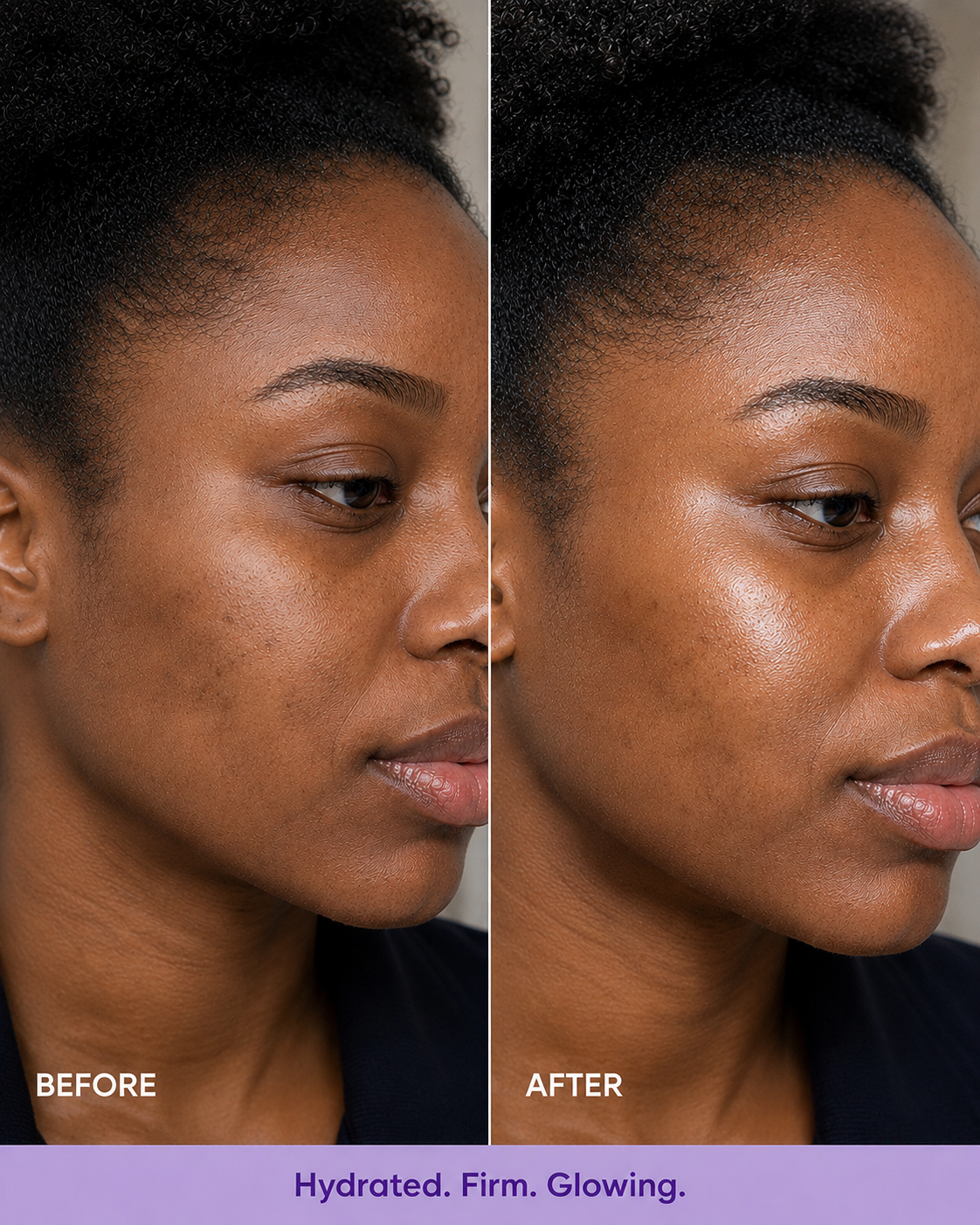 Hyaluronic Acid Face & Neck Moisturizing Cream